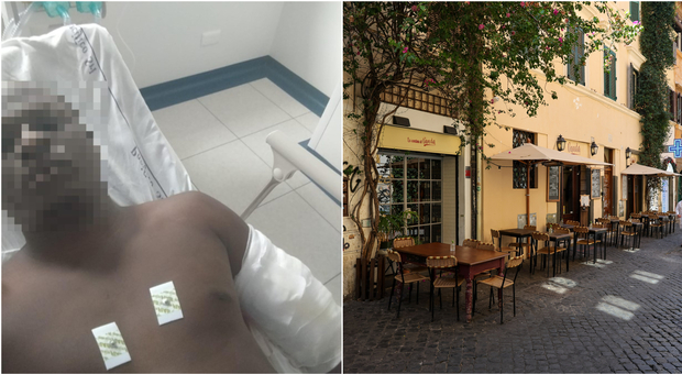 Sparatoria razzista a Trastevere: la vittima racconta l'aggressione a piazza Trilussa